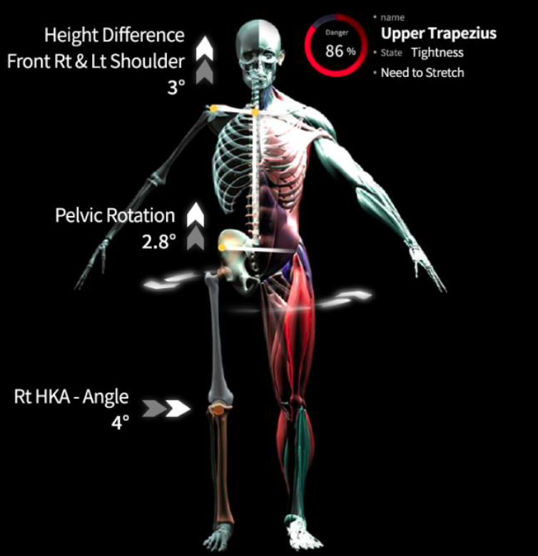 MotioScan Software Analysis