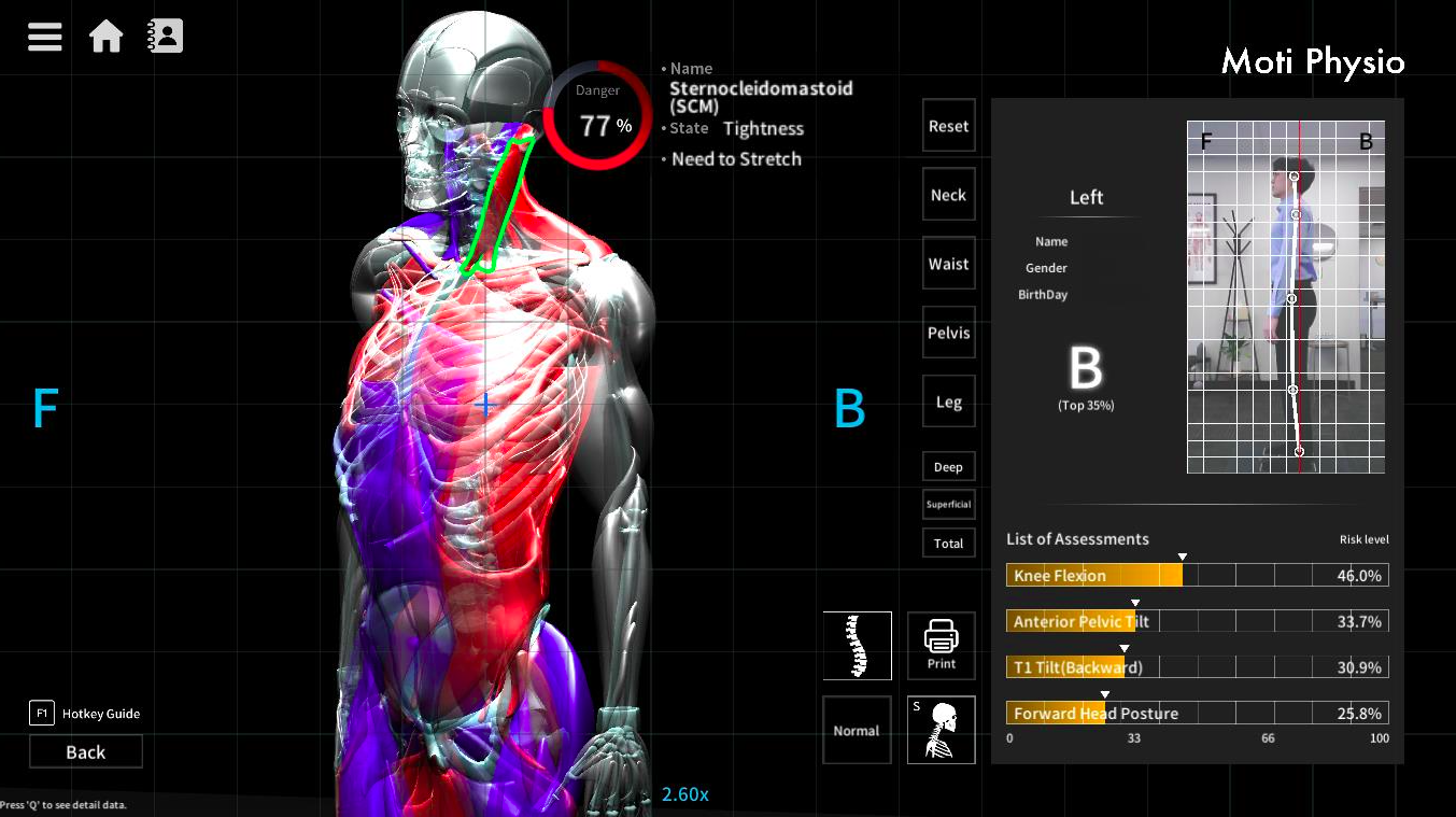 MotioScan Detailed Report